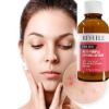 REVUELE ANTI-PIMPLE DRYING LOTION 30 ml